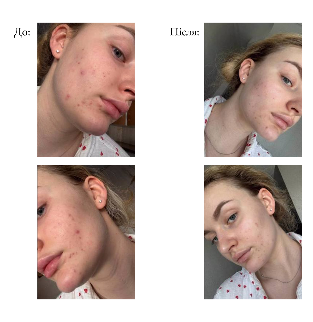 Персональний skincare аудит з лікарем-косметологом (розбір косметички|підбір догляду)-thumbmail-4